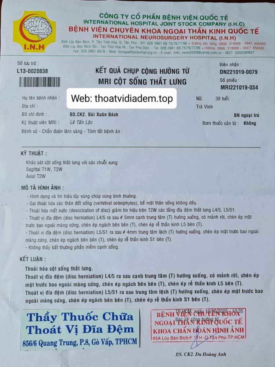 Kết quả chụp cộng hưởng từ MRI cột sống thắt lưng.